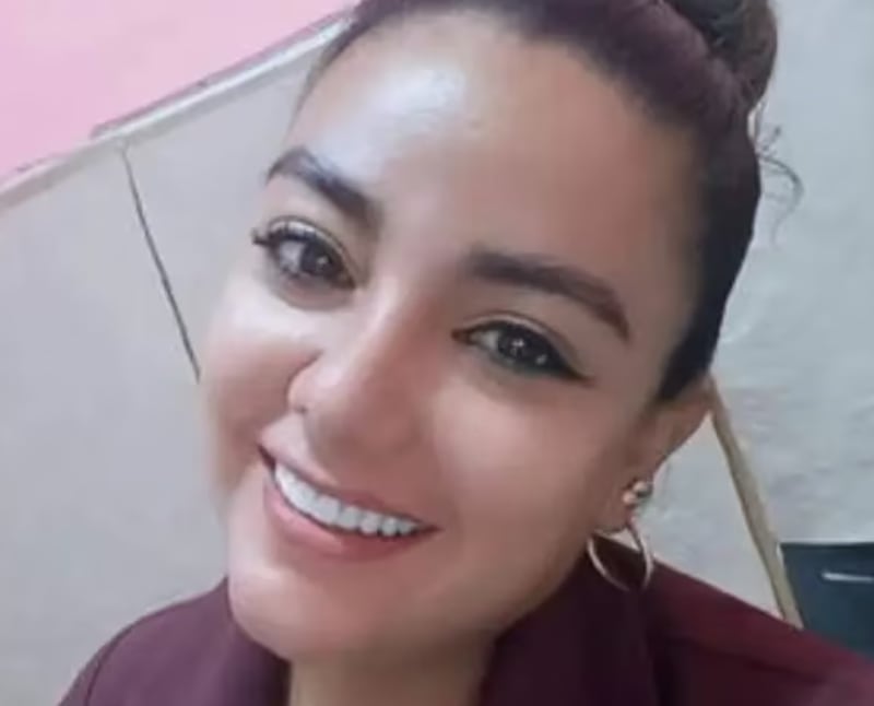 Yuliana Perea, cantante de Iquitos que murió tras someterse a una liposucción.